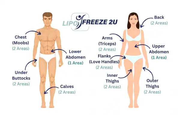 Areas you can have fat freezing treatment Isle of Isla