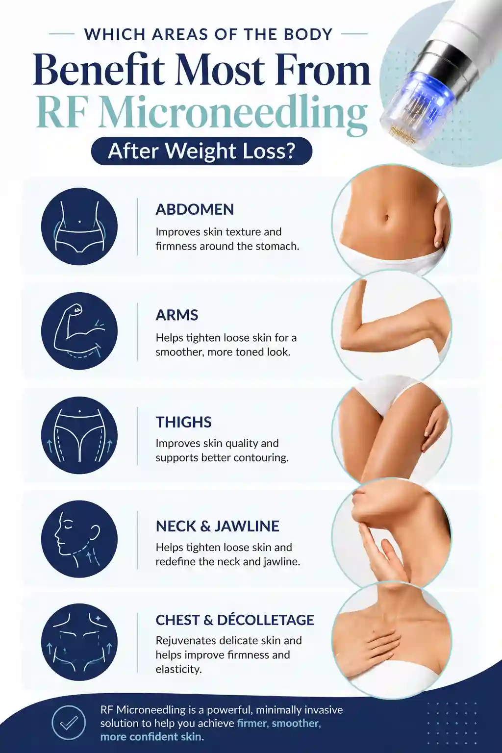 Which Areas of the Body Benefit Most From RF Microneedling After Weight Loss Isle of Isla